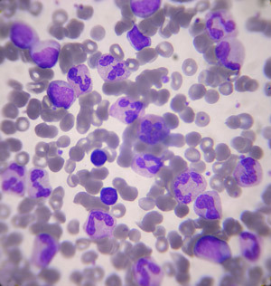 Weiße Blutzellen sind verantwortlich für die Abwehr des Körpers vor eindringenden Bakterien  