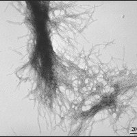 Ein Bild von gereinigten mutierten Huntingtin Protein Anhäufungen, die im Labor geformt werden. Diese Proteinklumpen werden ebenfalls in den Hirnzellen von Personen mit der HK gefunden.  