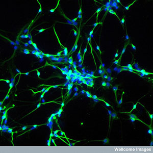 Stammzellen können dazu genutzt werden, im Labor zu Neuronen heranzuwachsen.