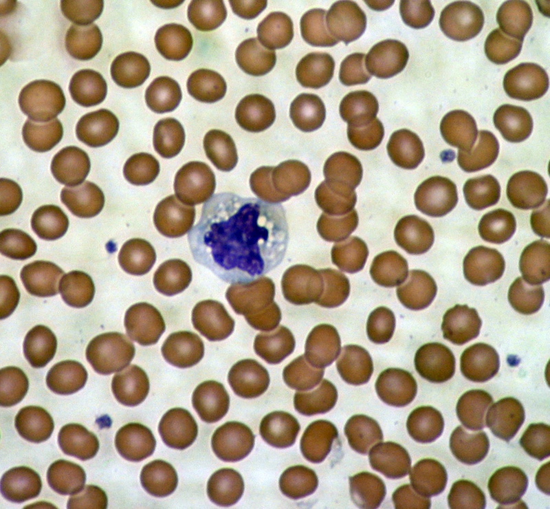 Ein mikroskopisches Bild der Blutkörperchen - rote Blutkörperchen umgeben eine einzelne Zelle des Immunsystems.