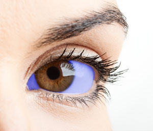 Wie in dieser künstlerischen Vorstellung gezeigt, führt Methylenblau zu einer Blaufärbung des Augapfels. Diese Eigenschaft könnte aufgrund des Placebo-Effekts Probleme für die klinische Untersuchung der Substanz mit sich bringen.