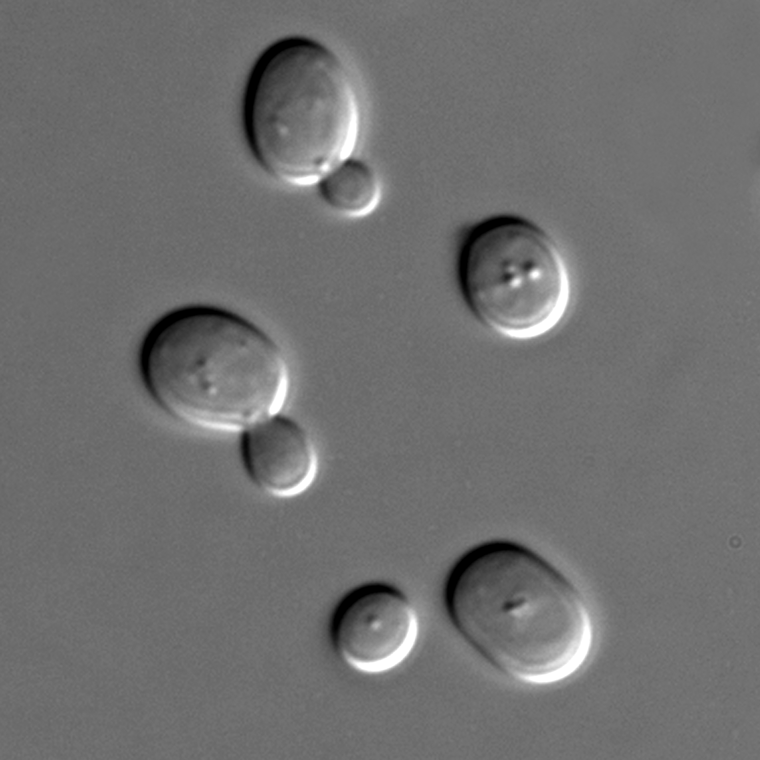 Winzige Hefezellen halfen Giorgini und Kollegen Proteine zu finden, die die Zellen vor dem mutierten Huntingtin-Protein schützen.