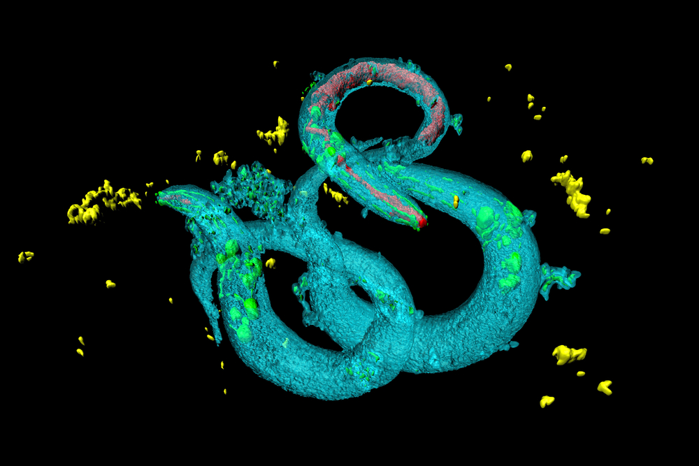 Mallucci's Gruppe identifizierte zwei Top-Kandidaten, nachdem über tausend Medikamente in Würmern namens C. elegans getestet wurden.