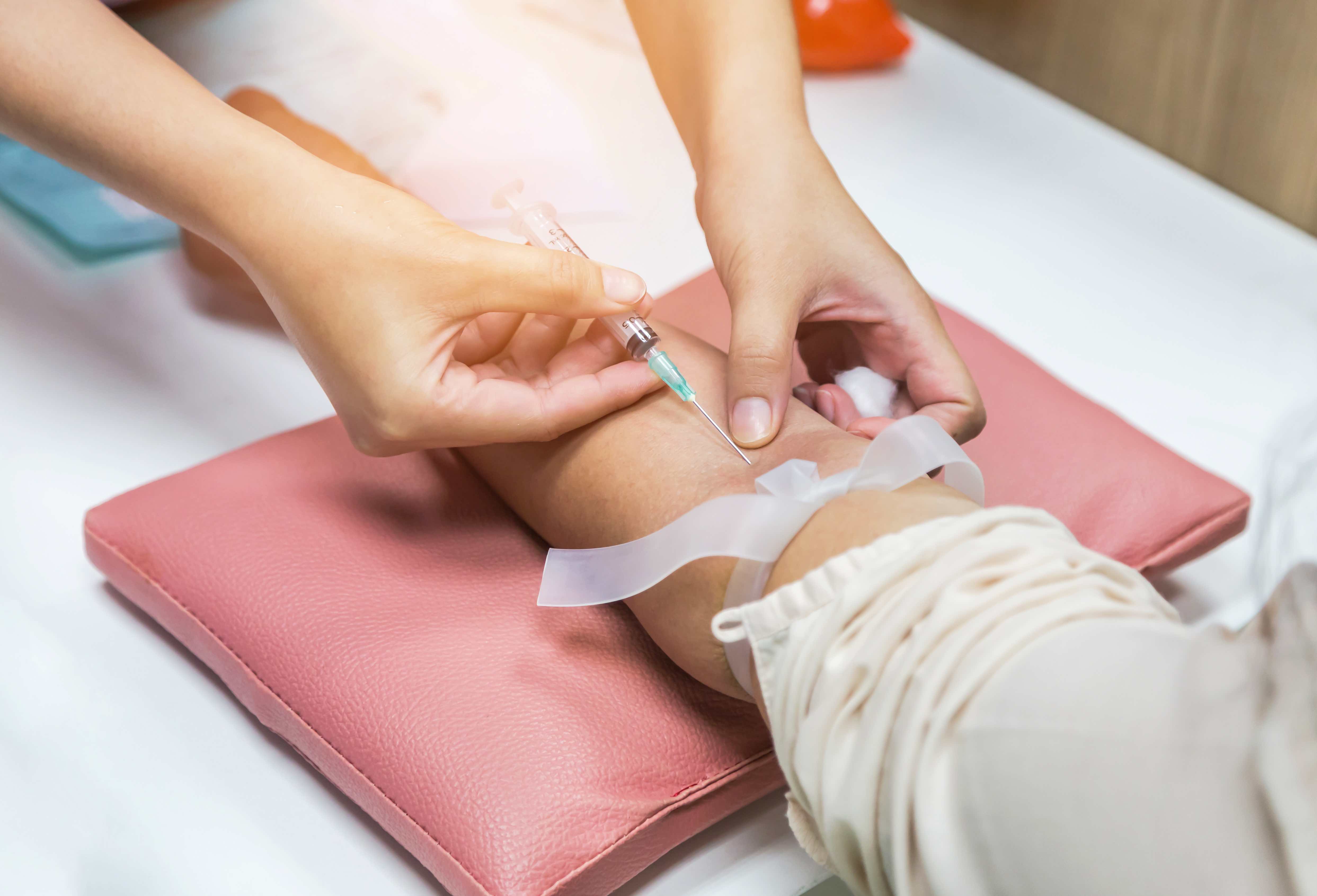 Anders als bisherige Biomarker für die Huntington-Krankheit, kann diese Untersuchung anhand einer einfachen Blutprobe durchgeführt werden.