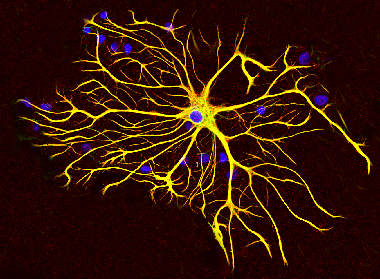Astrozyten unterstützen die Gesundheit der Neuronen, indem sie Chemikalien und Nährstoffe im Gehirn regulieren.
