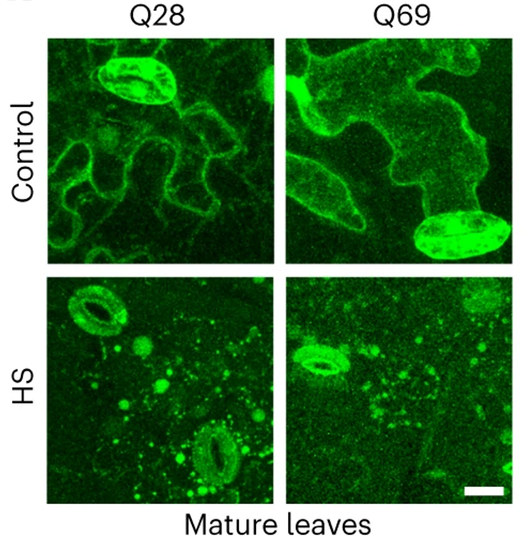 Die Wissenschaftler untersuchten die Pflanzen unter dem Mikroskop, um zu sehen, wo das Huntingtin-Protein, das hier grün dargestellt ist, unter normalen (Kontroll-) und Hitzeschock-Bedingungen (HS) zu finden war.