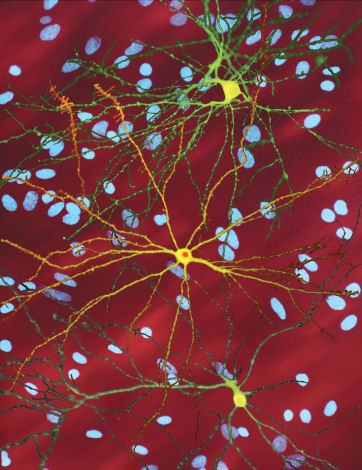 Bilder neuronaler Zellkultur aus Finkbeiners Labor. Zellen in grün und gelb wurden "markiert", so dass sie leuchten und somit die Form der Zelle erkennbar wird.  