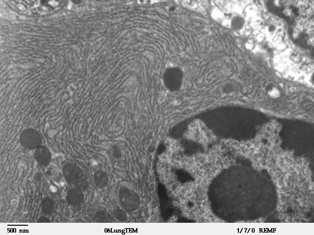 Die wellenförmigen Linien in diesem Bild sind das "endoplasmatische Retikulum" einer Zelle - ein Vorratsdepot für Kalzium. Ryanodin-Rezeptoren befinden sich auf diesen Strukturen.  