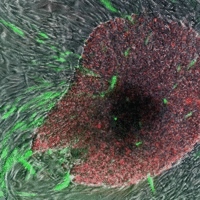 'Erzeugte, pluripotente Stammzellen' in grün und rot, die aus den sie umgebenden Hautzellen wachsen  