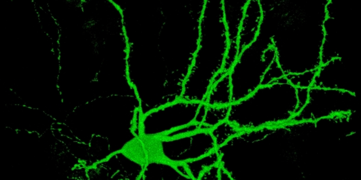 Hautzellen in Gehirnzellen umwandeln: ein Durchbruch in der Huntington-Forschung?