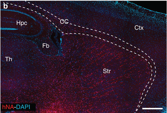 In diesem Bild aus der Originalstudie markiert jeder rote Punkt eine menschliche Gliazelle im erwachsenen Maushirn - Der Text und die Linien bezeichnen verschiedene Hirnregionen.  