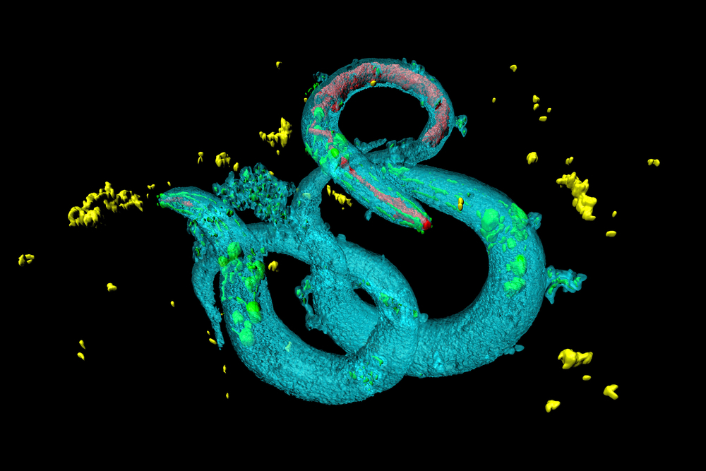 Mallucci's Gruppe identifizierte zwei Top-Kandidaten, nachdem über tausend Medikamente in Würmern namens C. elegans getestet wurden.  
