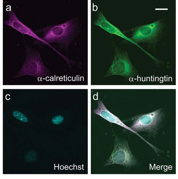 In dieser Mikroskopaufnahme aus Truants Labor, werden verschiedene Bereiche der Zelle in verschiedenen Farben dargestellt. Der Nukleus ist durch einen Farbstoff namens "Hoechst" markiert. Huntingtin wurde verändert, um grün zu leuchten, dies ermöglicht es seine Lokalisation innerhalb der Zelle zu bestimmen.  