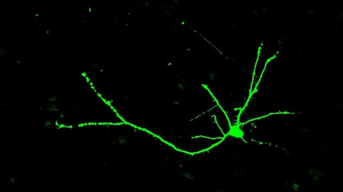 Nervenzellen sind wie Bäume geformt - mit einem Zellkörper, der viele Äste an der Spitze der Nervenzelle enthält, einem langen Stamm und einem verzweigten "Wurzelsystem" an der Unterseite der Zelle.  