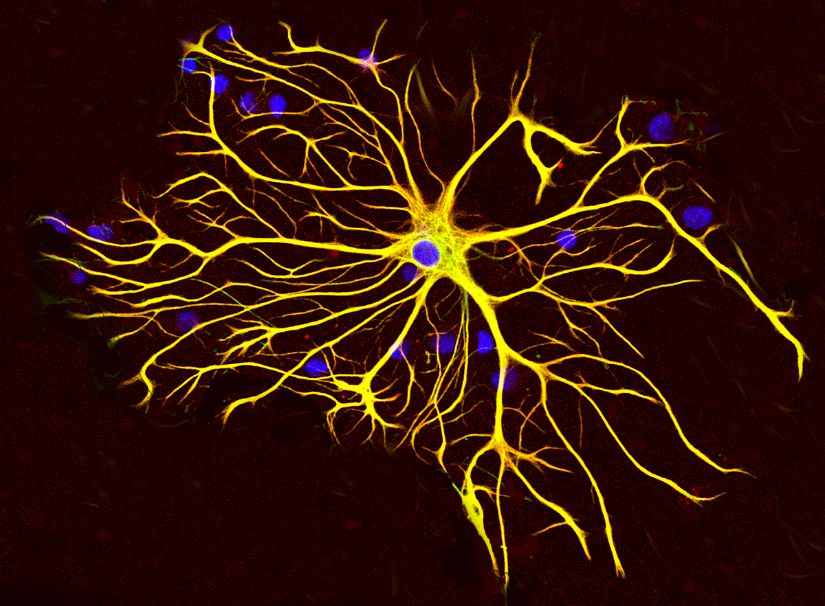 Astrozyten unterstützen die Gesundheit der Neuronen, indem sie Chemikalien und Nährstoffe im Gehirn regulieren.  