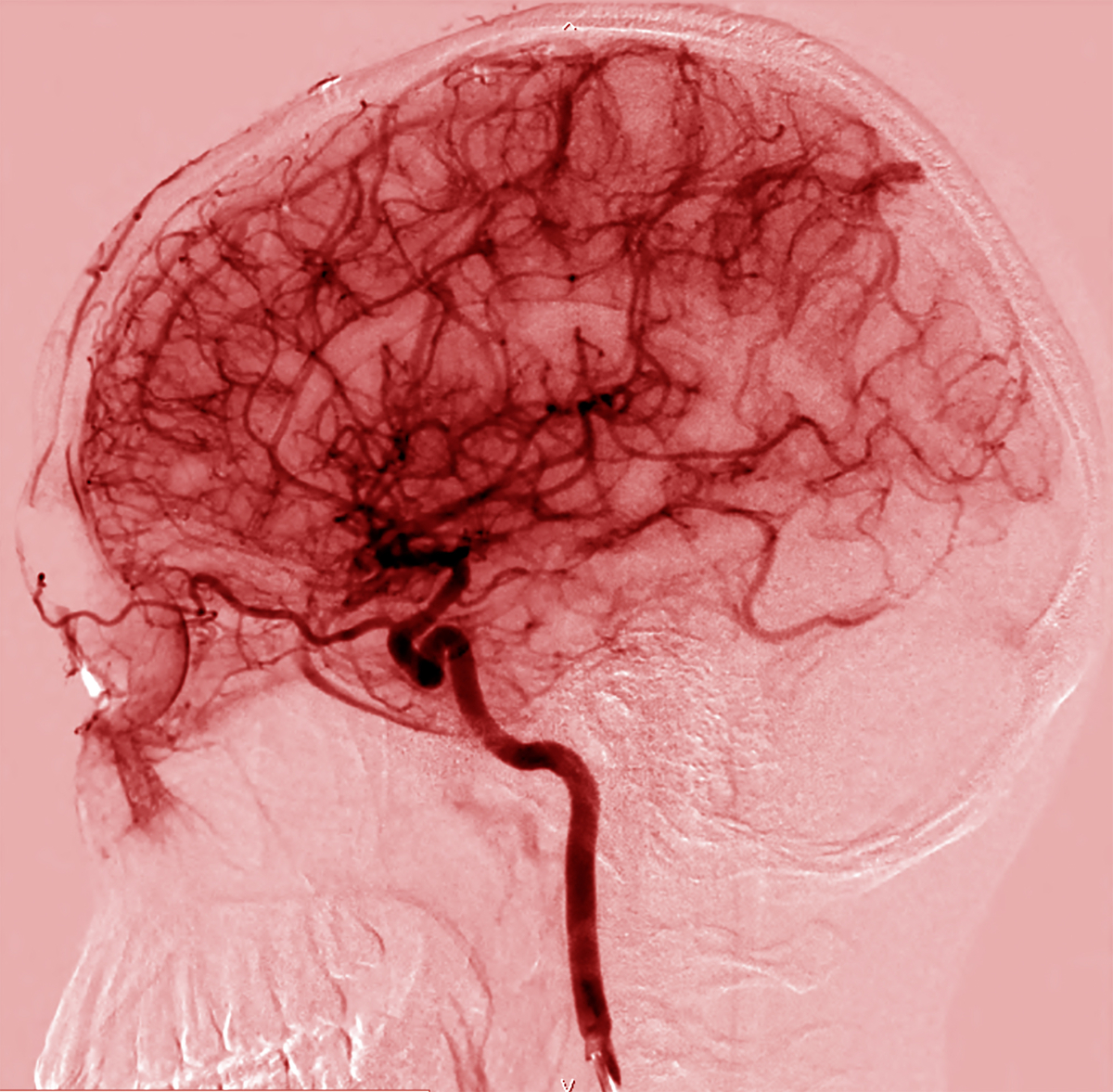 Dies ist ein Bild der vielen Blutgefäße des Gehirns. Die Zellen, die diese Gefäße auskleiden, bilden die Blut-Hirn-Schranke.   