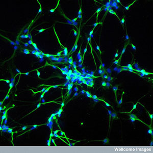Stammzellen können dazu genutzt werden, im Labor zu Neuronen heranzuwachsen.  