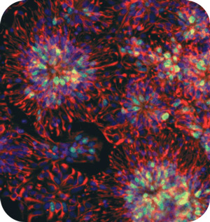 Neuronale Stammzellen machen die richtigen Verbindungen